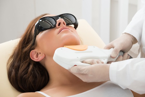 laser hair removal